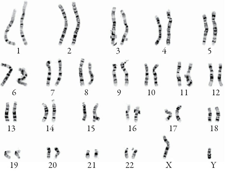 Researchers Determine The Complete Assembly Sequence Of A Human X  Chromosome - Tech Life